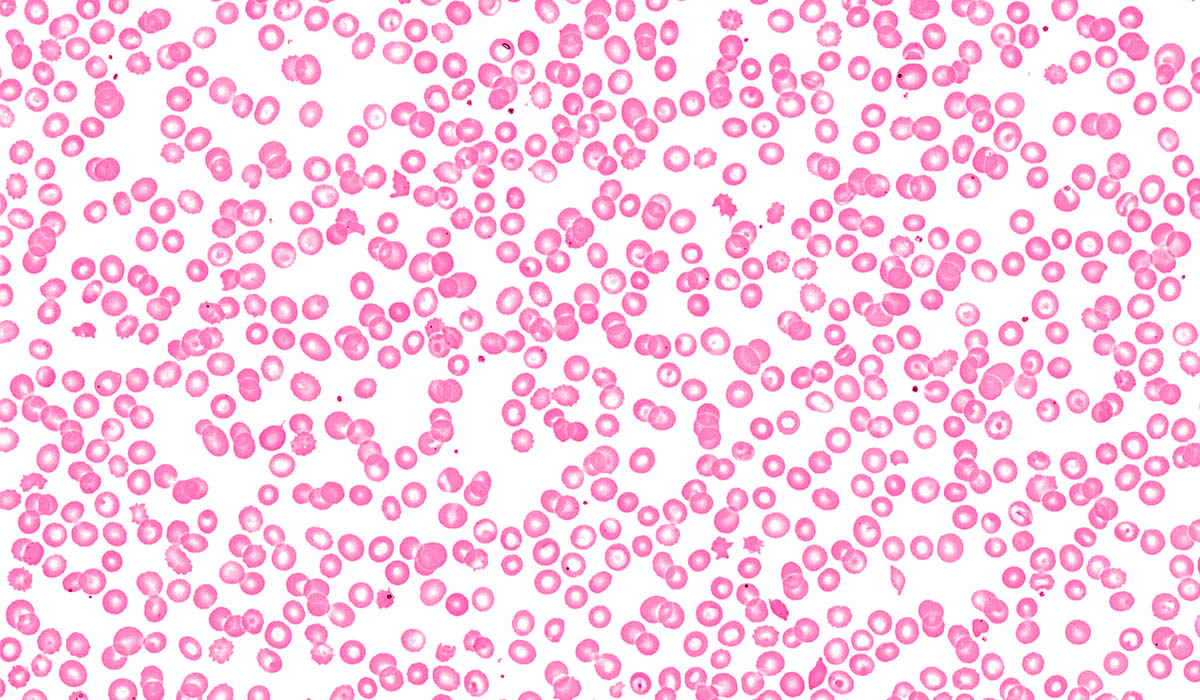 The Emergence of Biotech DAOs